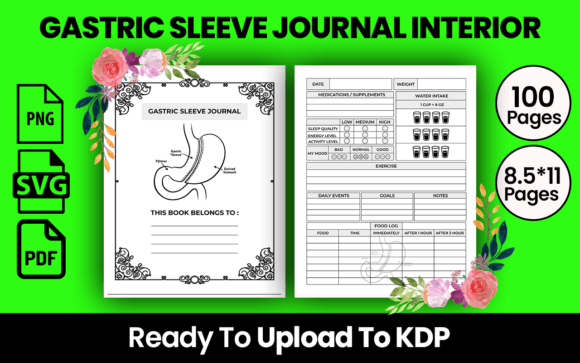 Your Companion for the Journey: Understanding the Gastric Sleeve Journal KDP Interior